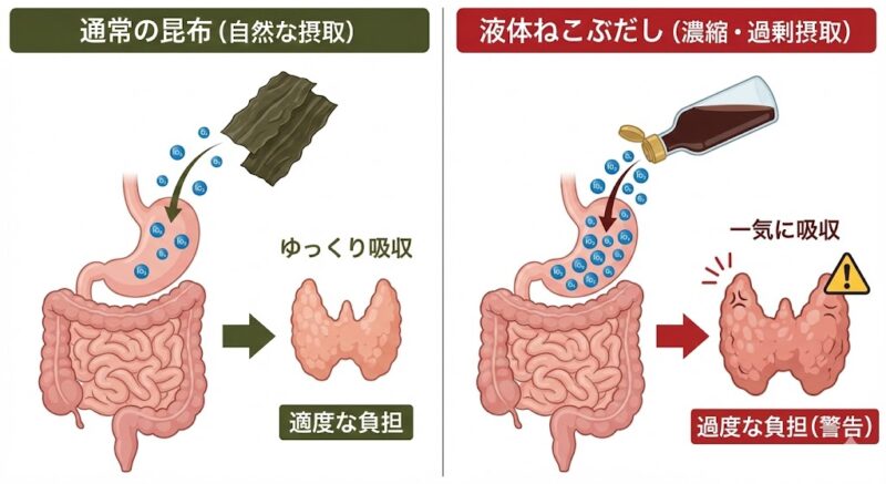 自然な昆布と濃縮された液体出汁によるヨウ素摂取の濃度差と甲状腺への影響を示す模式図