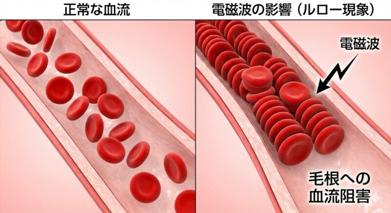 正常な赤血球と、電磁波の影響でルロー現象（連鎖形成）を起こしドロドロになった赤血球の比較図解。毛根への血流が阻害されるメカニズム。